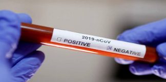Hasil Swab Negatif, 1 Daftar PDP di Rohul Dipulangkan