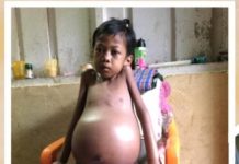 Rifa, Bocah Bocor Jantung di Ujung Batu Pernah Dirawat di RSUD Rohul, Namun Harus Pulang Karena Kurang Data Administrasi