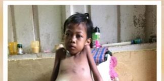 Rifa, Bocah Bocor Jantung di Ujung Batu Pernah Dirawat di RSUD Rohul, Namun Harus Pulang Karena Kurang Data Administrasi