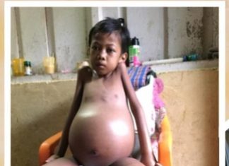 Rifa, Bocah Bocor Jantung di Ujung Batu Pernah Dirawat di RSUD Rohul, Namun Harus Pulang Karena Kurang Data Administrasi