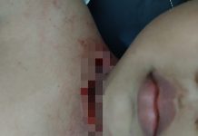 KECEWA, Orang Tua Korban Penganiayaan Tempuh Jalur Hukum, Pelaku Disebut Gila