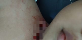 Pelajar SMP Duga Aniaya Bocah 4 Tahun Dengan Luka Sayatan di Leher dan Perut