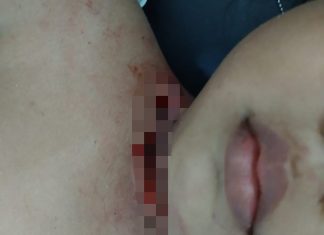 Kasus Penganiayan Oleh Pelajar SMP Terhadap Bocah Malang Tetap Berlanjut