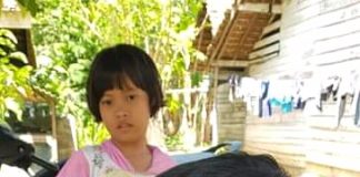 Derita Sohibul Aziz, Bocah Enam Tahun Menderita Pembengkakan di Leher