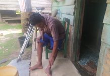Keluh Kesah “DOGOL”, Tak Mampu Bekerja Karena Patah Tulang