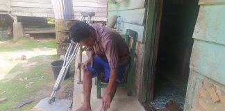 Keluh Kesah “DOGOL”, Tak Mampu Bekerja Karena Patah Tulang