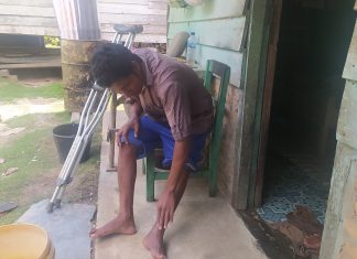 Keluh Kesah “DOGOL”, Tak Mampu Bekerja Karena Patah Tulang